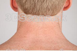 Neck texture of Alberto 0002